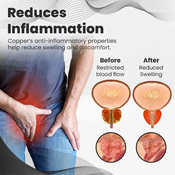 CopperMag Prostate Therapy Ring (BUY 1 GET 1  FREE)